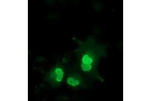 Anti-EPM2AIP1 mouse monoclonal antibody (ABIN2452999) immunofluorescent staining of COS7 cells transiently transfected by pCMV6-ENTRY EPM2AIP1 (RC209239). (EPM2AIP1 antibody)