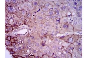 Immunohistochemistry (IHC) image for anti-RAB4A, Member RAS Oncogene Family (RAB4A) antibody (ABIN1108812) (Rab4 antibody)