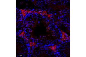 Immunofluorescence of paraffin embedded mouse testis using Cep78 (ABIN7073432) at dilution of 1:400 (300x lens) (CEP78 antibody)