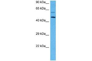 Host:  Mouse  Target Name:  EPOR  Sample Tissue:  Mouse Skeletal Muscle  Antibody Dilution:  1ug/ml (EPOR antibody  (N-Term))