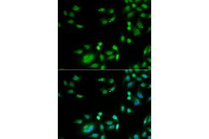 Immunofluorescence analysis of A549 cells using INTS10 antibody.
