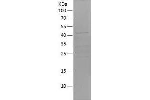 Western Blotting (WB) image for Forkhead Box O6 (Foxo6) (AA 123-342) protein (His-IF2DI Tag) (ABIN7122995) (Foxo6 Protein (AA 123-342) (His-IF2DI Tag))