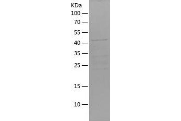 Foxo6 Protein (AA 123-342) (His-IF2DI Tag)