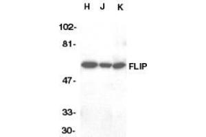 Western blot analysis of FLIP in HeLa (H), Jurkat (J), and K562 (K) whole cell lysate with AP30342PU-N FLIP antibody at 1/1000 dilution.
