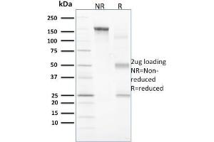 SDS-PAGE Analysis Purified Vinculin Mouse Monoclonal Antibody (VCL/2573). (Vinculin antibody  (AA 174-322))