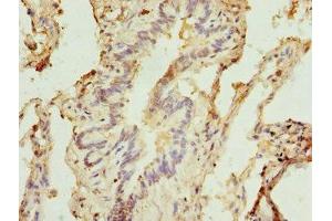 Immunohistochemistry of paraffin-embedded human lung tissue using ABIN7171242 at dilution of 1:100 (Syntaxin 5 antibody  (AA 55-355))