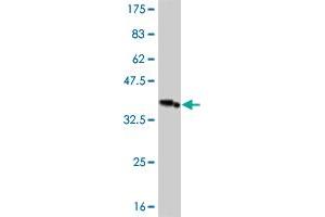 Western Blot detection against Immunogen (36. (IRAK3 antibody  (AA 497-596))