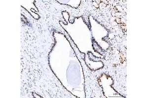 IHC analysis of DDX1 using anti-DDX1 antibody (ABIN7602052). (DDX1 antibody  (AA 562-740))