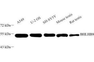 Western blot analysis of BHLHB9 (ABIN7073183) at dilution of 1: 1000