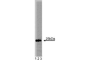 Western blot analysis of Rab5 on a human endothelial cell lysate. (RAB5 antibody  (AA 1-215))
