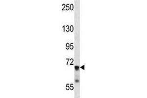IL1R1 antibody western blot analysis in mouse liver tissue lysate
