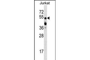 CUGBP2 Antibody (C-term) (ABIN1537389 and ABIN2848868) western blot analysis in Jurkat cell line lysates (35 μg/lane).