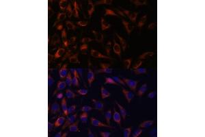 Immunofluorescence analysis of L929 cells using WFDC1 antibody (ABIN7271344) at dilution of 1:100. (WFDC1 antibody  (AA 111-220))