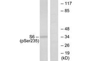 Western blot analysis of extracts from 293 cells treated with serum 10% 15', using S6 Ribosomal Protein (Phospho-Ser235) Antibody. (RPS6 antibody  (pSer235))