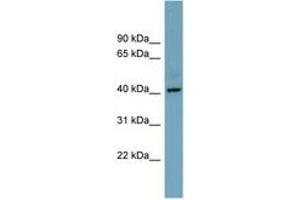 Image no. 1 for anti-Chromosome X Open Reading Frame 66 (CXorf66) (AA 215-264) antibody (ABIN6743320) (CXorf66 antibody  (AA 215-264))