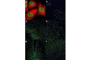 Immunofluorescent staining of U-251 MG (A), mouse midbrain (B), mouse piriform cortex (C), mouse hypothalamus (D, E) and mouse visual cortex (F) with ZNF3 polyclonal antibody  (Green).