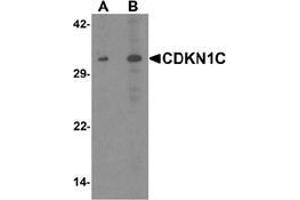 Western blot analysis of CDKN1C in 293 cell lysate with CDKN1C Antibody  at (A) 1 and (B) 2 μg/ml. (CDKN1C antibody  (N-Term))
