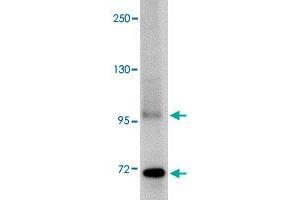 Western blot analysis of TNFAIP3 in SK-N-SH cell lysate with TNFAIP3 polyclonal antibody  at 1 ug/mL . (TNFAIP3 antibody  (C-Term))