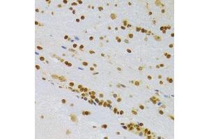 Immunohistochemistry of paraffin-embedded rat brain using HMGB1 Antibody. (HMGB1 antibody  (AA 100-200))