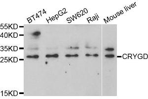Western blot analysis of extracts of various cell lines, using CRYGD antibody. (CRYGD antibody)
