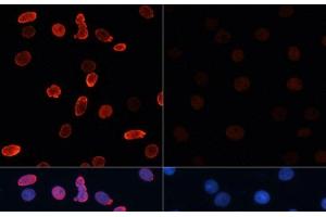 Immunofluorescence (IF) image for anti-Histone H2B (acLys15) antibody (ABIN7258526)