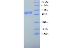 WNT8A Protein (AA 23-358) (His tag)