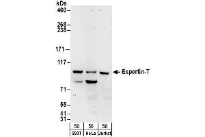 anti-Exportin, tRNA (Nuclear Export Receptor For TRNAs) (XPOT) (AA 912-962) antibody