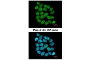 ICC/IF Image Immunofluorescence analysis of paraformaldehyde-fixed A431, using Bloom syndrome protein, antibody at 1:200 dilution. (BLM antibody  (C-Term))