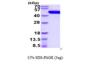SDS-PAGE (SDS) image for Plasminogen Activator, Urokinase (PLAU) (AA 21-431) protein (His tag) (ABIN7529337) (PLAU Protein (AA 21-431) (His tag))