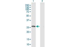Western Blot analysis of GSTO1 expression in transfected 293T cell line by GSTO1 MaxPab polyclonal antibody. (GSTO1 antibody  (AA 1-241))