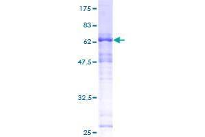 SAP30BP Protein (AA 1-308) (GST tag)
