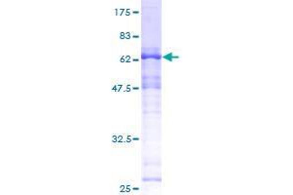 SAP30BP Protein (AA 1-308) (GST tag)