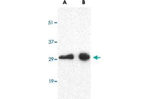 Western blot analysis of CD274 in Raji cell lysate with CD274 polyclonal antibody  at (A) 0. (PD-L1 antibody  (Internal Region))