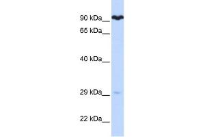 SUPV3L1 antibody used at 1 ug/ml to detect target protein. (SUPV3L1 antibody)