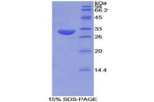 SDS-PAGE (SDS) image for Tubulin, epsilon 1 (TUBE1) (AA 236-473) protein (His tag) (ABIN1878185) (TUBE1 Protein (AA 236-473) (His tag))