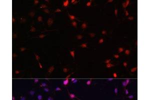Immunofluorescence analysis of C6 cells using c-Fos Polyclonal Antibody at dilution of 1:100. (c-FOS antibody)
