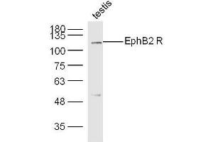 Mouse testis lysates probed with Rabbit Anti-EphB2 R Polyclonal Antibody, Unconjugated  at 1:300 overnight at 4˚C. (EphB2 R (AA 101-200) antibody)