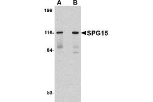 Western Blotting (WB) image for anti-Zinc Finger, FYVE Domain Containing 26 (ZFYVE26) (C-Term) antibody (ABIN1030693) (ZFYVE26 antibody  (C-Term))