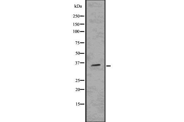 SIX2 antibody  (Internal Region)