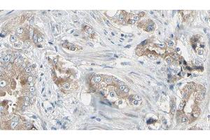 ABIN6278748 at 1/100 staining Human prostate tissue by IHC-P. (LRRK1 antibody  (C-Term))