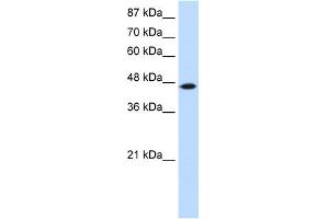 WB Suggested Anti-TRIT1 Antibody Titration:  0. (TRIT1 antibody  (C-Term))