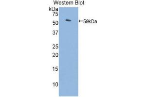 Western Blotting (WB) image for anti-Protein S (PROS) (AA 261-496) antibody (ABIN1860321) (PROS1 antibody  (AA 261-496))