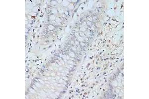 Immunohistochemistry of paraffin-embedded human colon using TCEB2 antibody (ABIN6131621, ABIN6148934, ABIN6148936 and ABIN6217328) at dilution of 1:100 (40x lens).