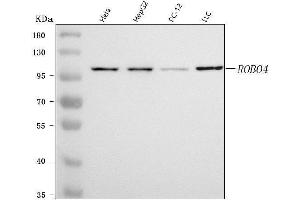 Western blot analysis of ROBO4 using anti-ROBO4 antibody (ABIN7599692).