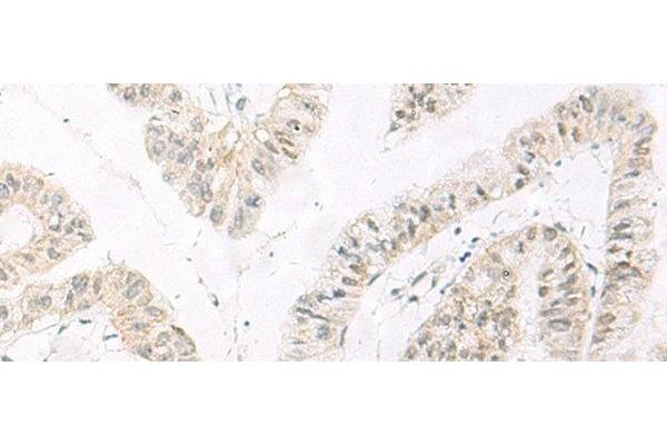 HABP4 antibody