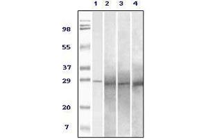Western blot analysis using Rab25 mouse mAb against truncated Rab25 recombinant protein (1), human overy carcinoma(2), stomach carcinoma (3), breast carcinoma (4) tissue lysate. (RAB25 antibody)