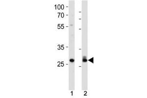 Western Blotting (WB) image for anti-Cyclin-Dependent Kinase 2 (CDK2) (AA 1-30) antibody (ABIN3030606)