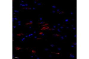 Immunofluorescence of paraffin embedded rat spinal cord using NACAD (ABIN7074756) at dilution of 1:650 (400x lens) (NACAD antibody)