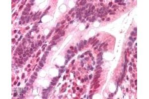 ABIN185143 (5µg/ml) staining of paraffin embedded Human Small Intestine. (POLL antibody  (C-Term))