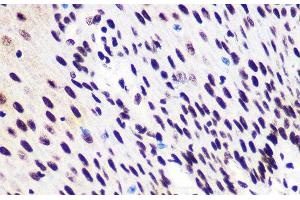 Immunohistochemistry (Paraffin-embedded Sections) (IHC (p)) image for anti-SMAD, Mothers Against DPP Homolog 2 (SMAD2) (pSer423), (pSer425), (pSer465), (pSer467) antibody (ABIN7265256)
